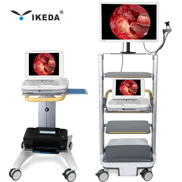 Medical endoscope/portable hysteroscope endoscopy