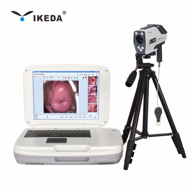 Hình ảnh soi cổ tử cung tốt Máy ảnh soi cổ tử cung HD,giá thấp Hình ảnh soi  cổ tử cung tốt Máy ảnh soi cổ tử cung HD Purchasing