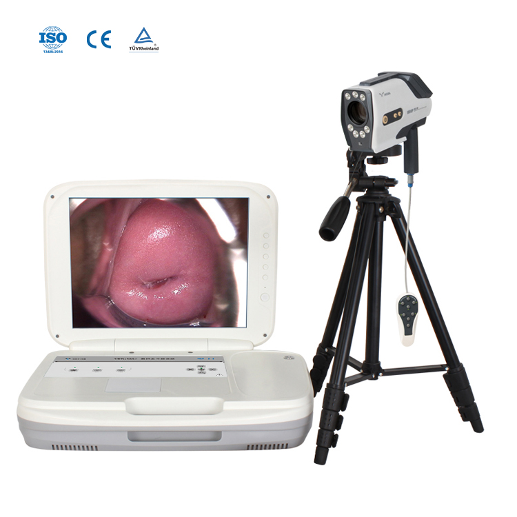 Colposcópio Digital Imaging System para exame da vagina