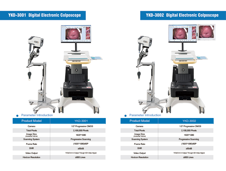 digital colposcopy system