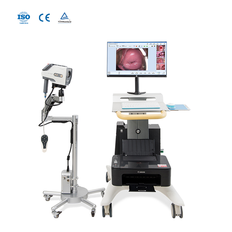 子宮頸部膣検査用のデジタルビデオコルポスコープ機器