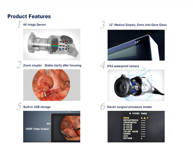 UHD Endoscopy