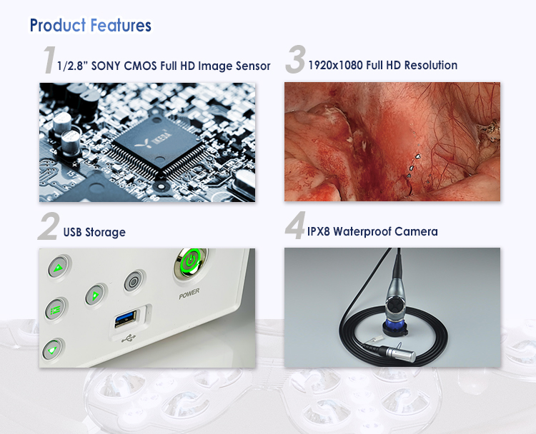 Endoscope Camera System