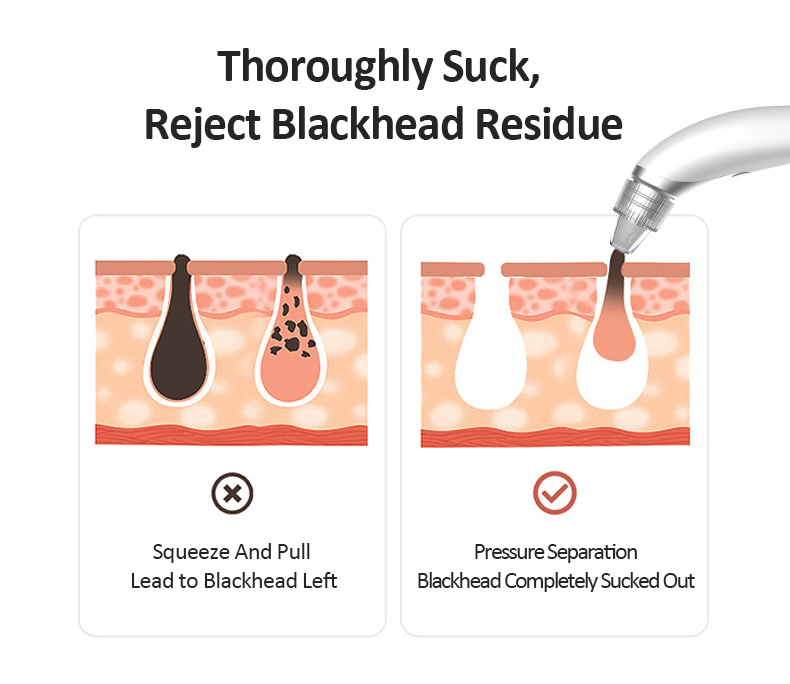 Rechargeable Pore Cleaner
