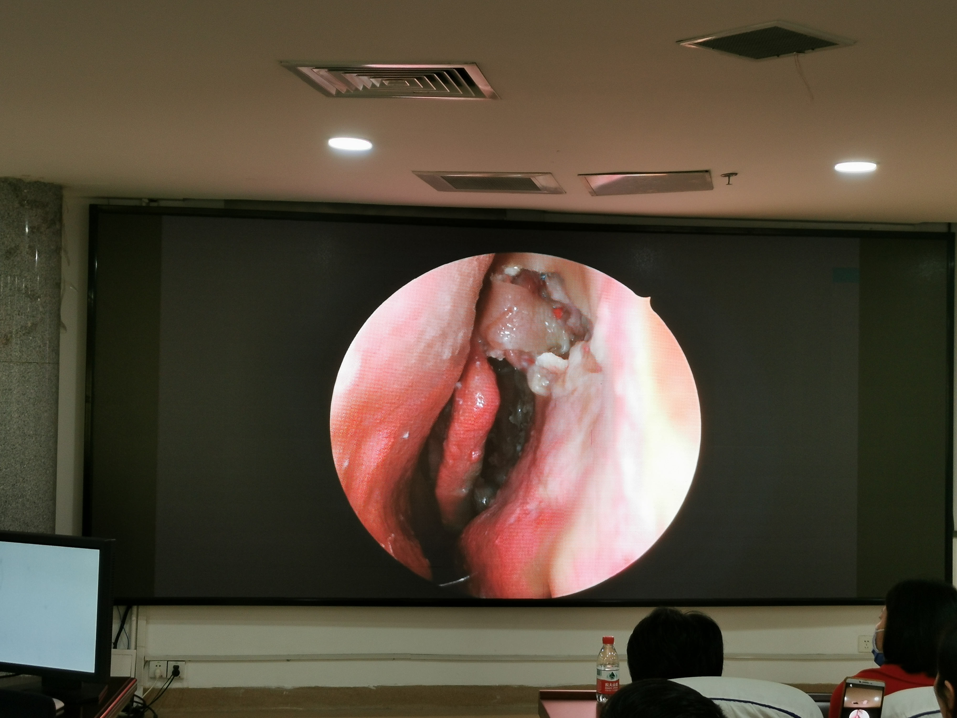 Dajing Endoscope Camera System Used in Hospital