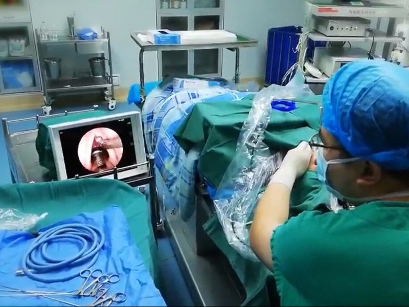 Operação de larnoscópio por câmera endoscópica sem fio
