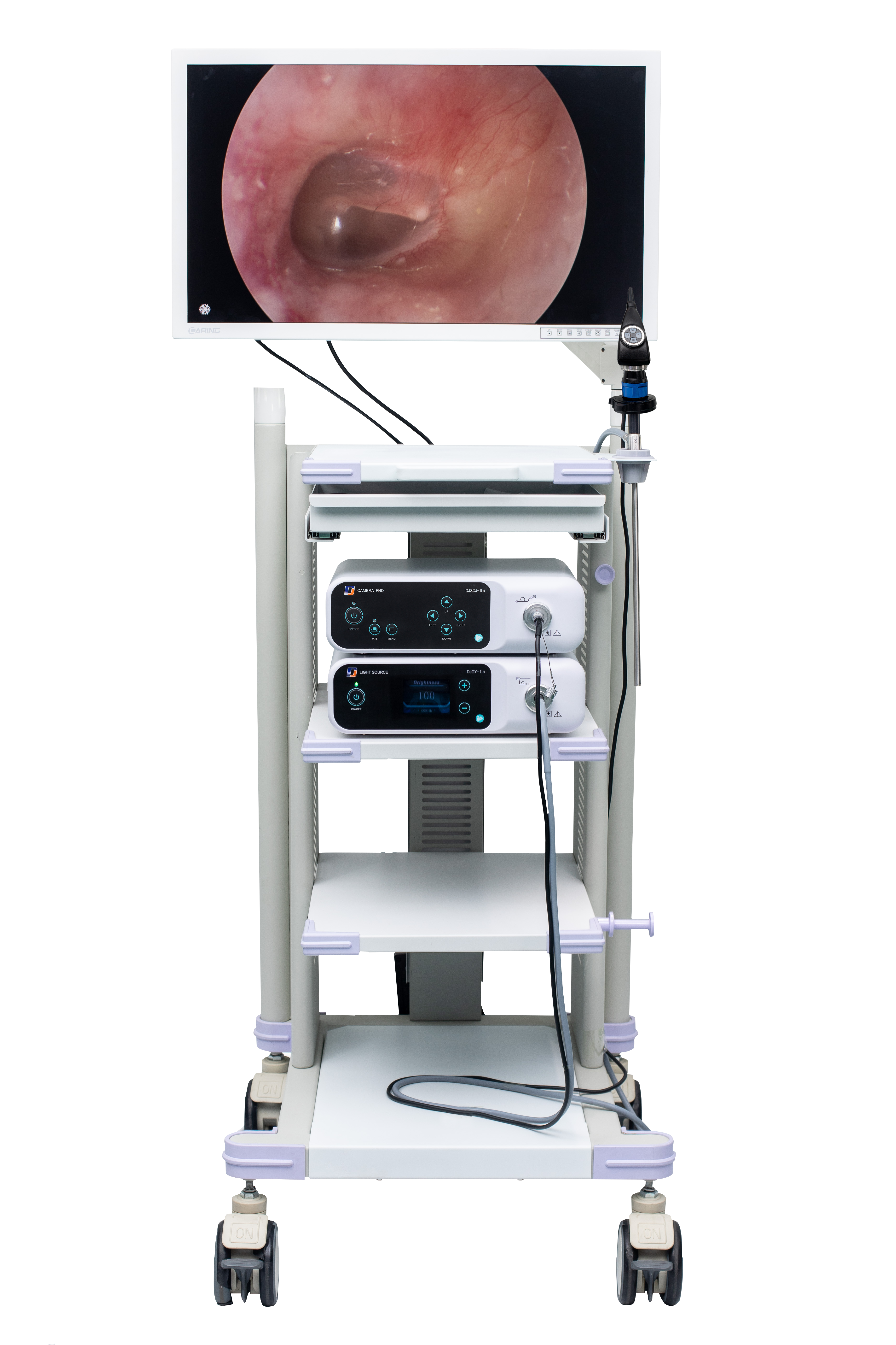 ENT endoscope camera system