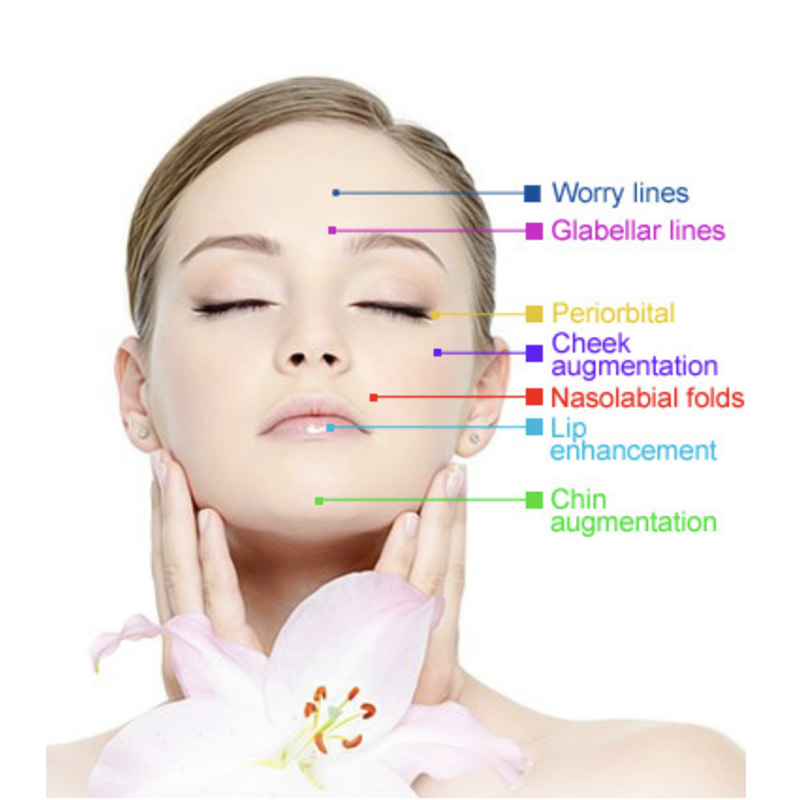Hyaluronic Acid, Singfiller Deep Hyaluronic Acid Injection, Skin