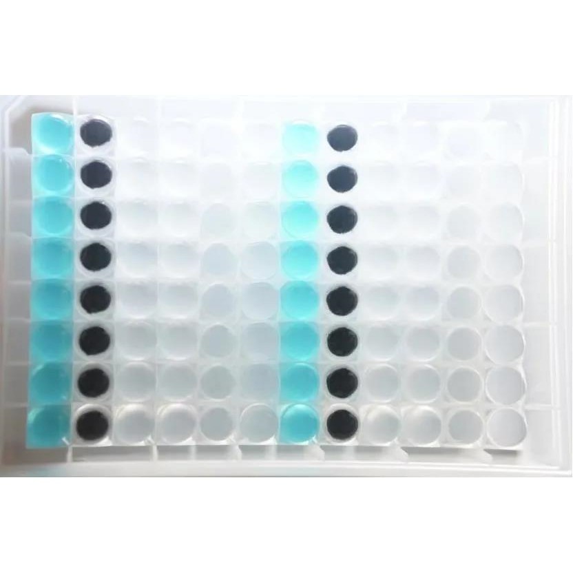 Tuberculous Bacillus DNA Extraction Kit