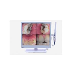 Monitor de cámara intraoral dental de 17 pulgadas