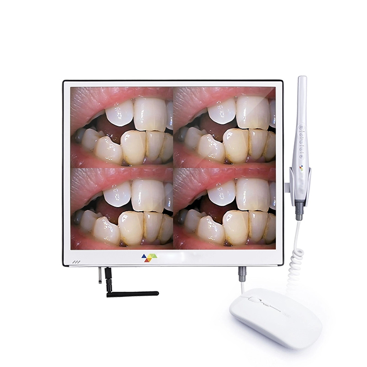 HD Touch Screen Intraoral Camera