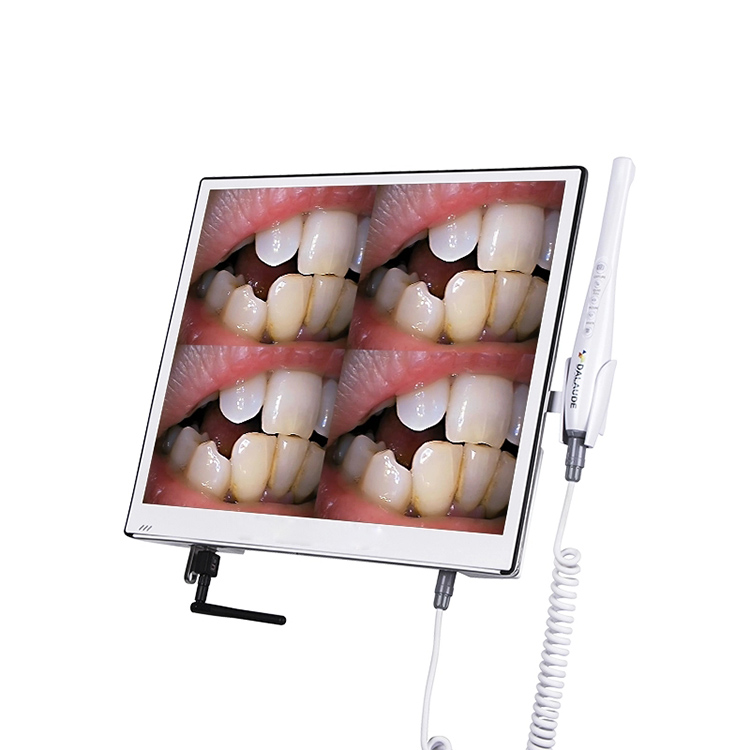 HD Touch Screen Intraoral Camera