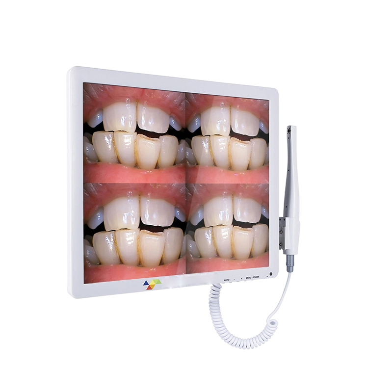 Intraoral Camera With Monitor Intraoral Camera With Monitor