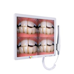 Câmera intraoral com monitor