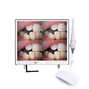 Kamera Intraoral Digital Dengan Layar