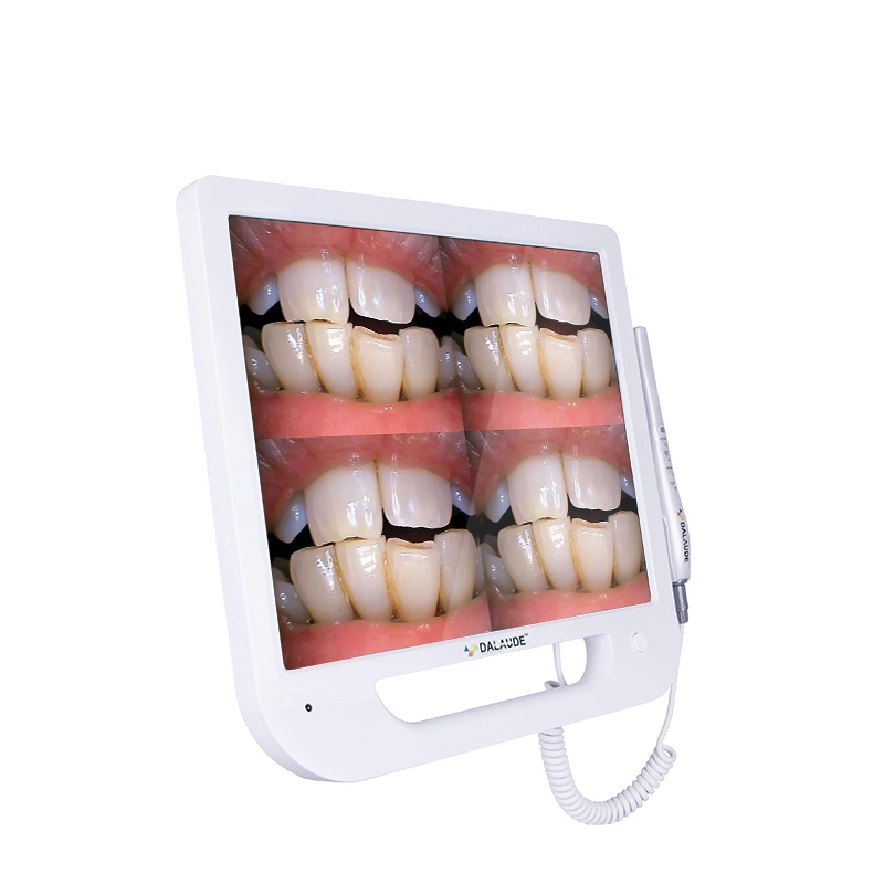 Mouthwatch Dental Camera