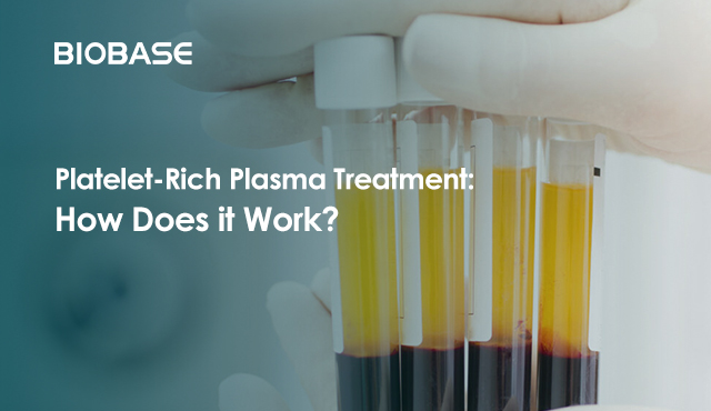 Tratamiento con plasma rico en plaquetas: ¿cómo funciona?
