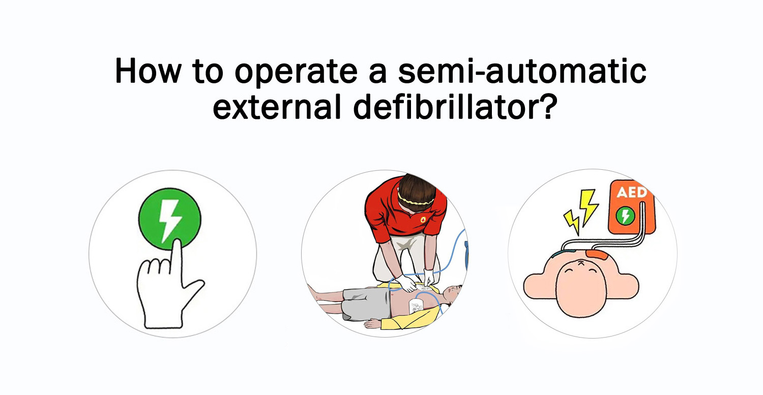 The guardian of life: Semi-automated external defibrillator!