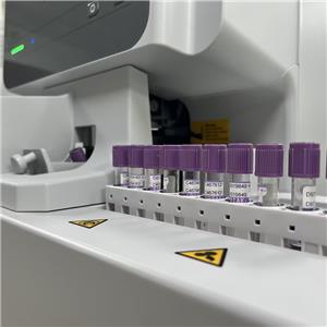 Analizador hematológico de 5 partes BK-6500 Biobase — imagen 4