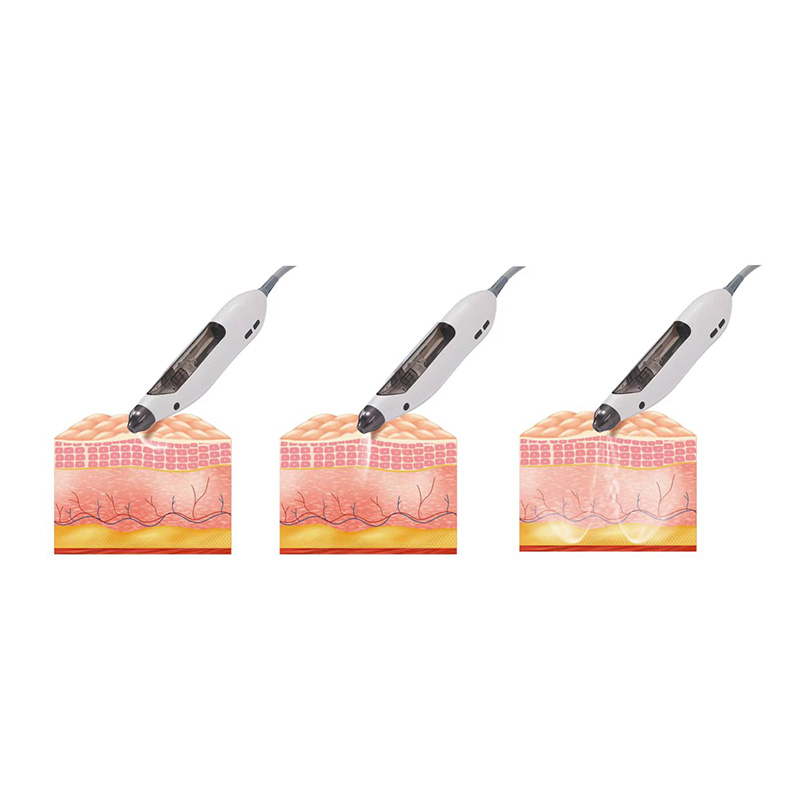 Non-invasive Water Instrument