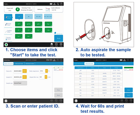 blood gas analyzer manufacturer china