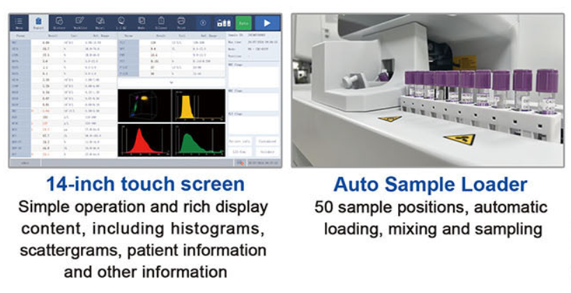 5-part hematology analyzer