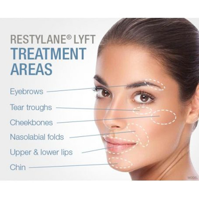 Supply Restylane Lyft Lidocaine Hyaluronic Acid Dermal Filler for Lips Wholesale Factory JINAN