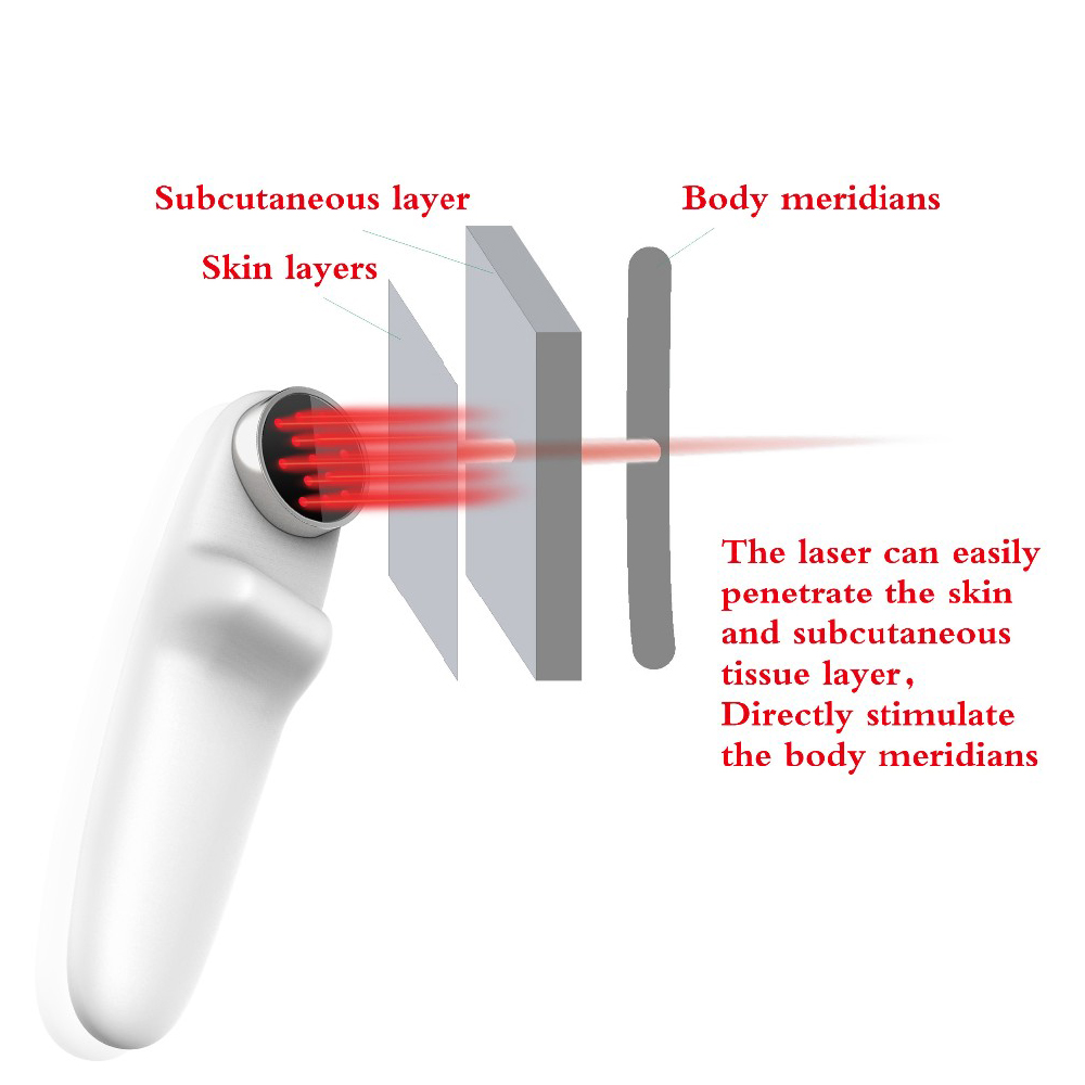 Back Pain Relief Acupuncture Low Level Laser Therapy