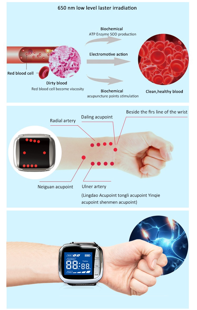 laser therapy wrist watch