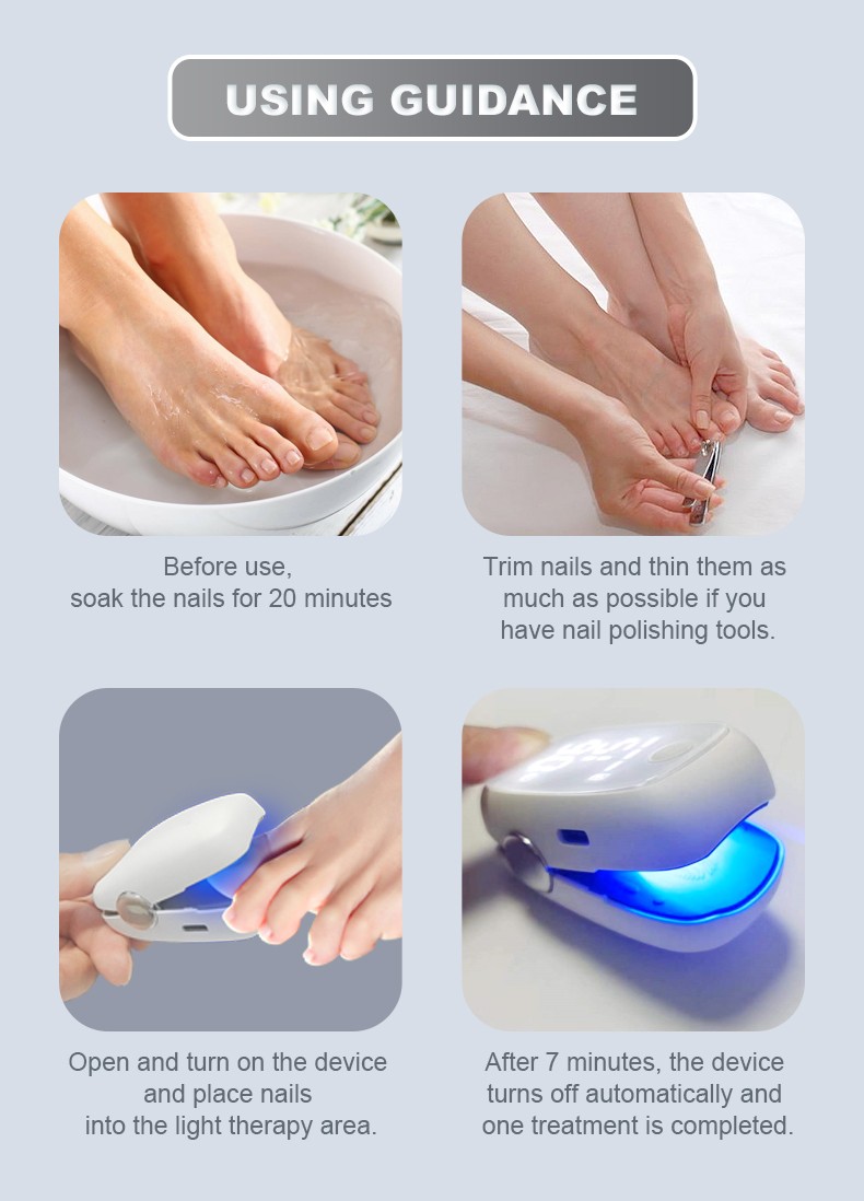 Laser therapy for nail fungus