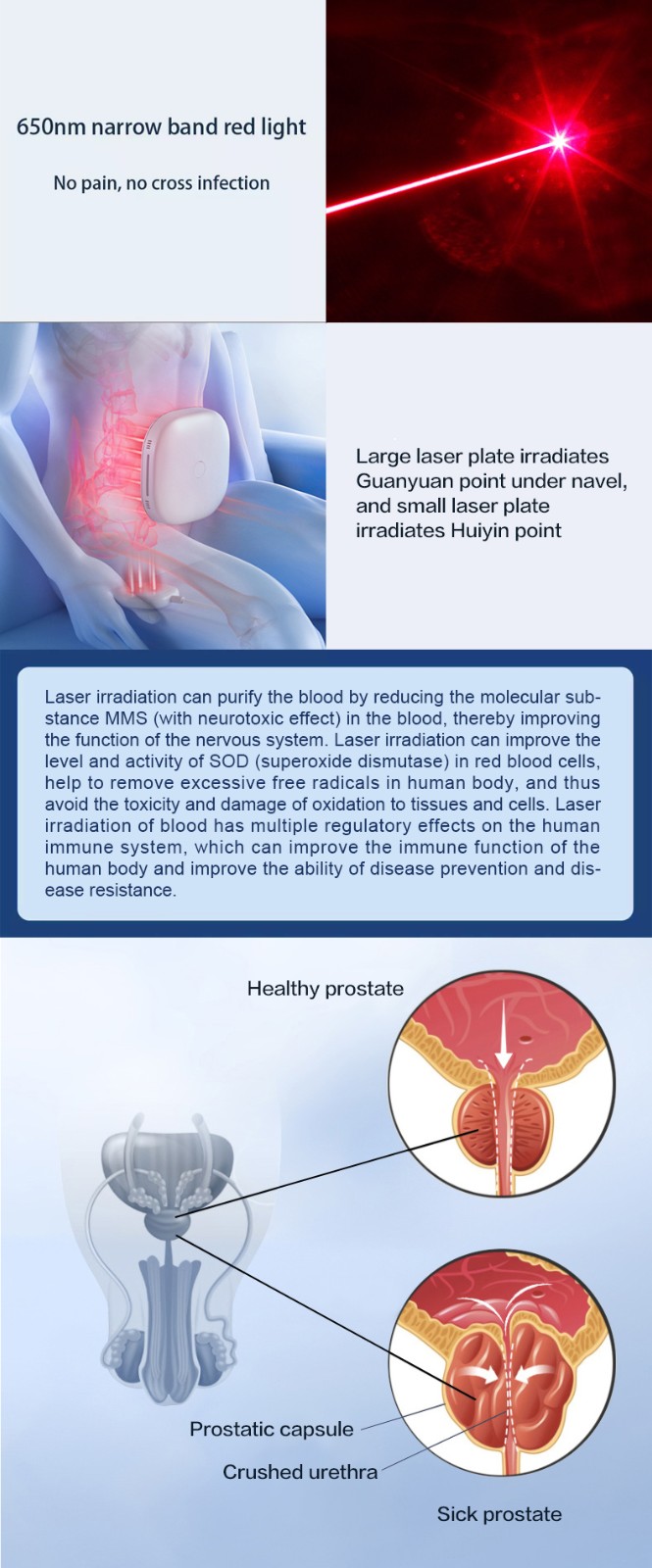 Inflammation Elimination Urinary Tract Infections