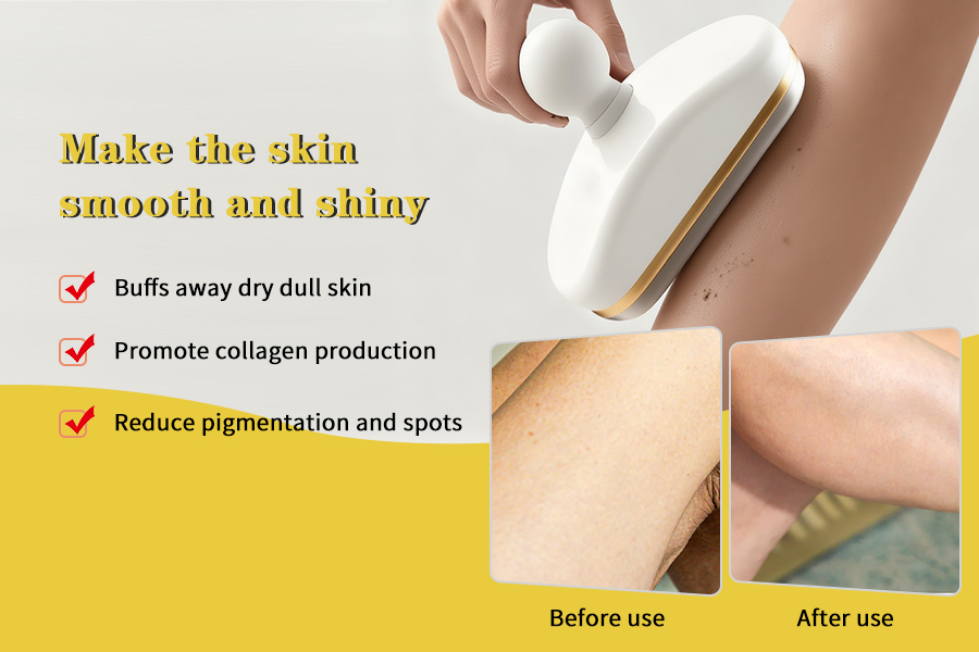Microdermabrasion Tool