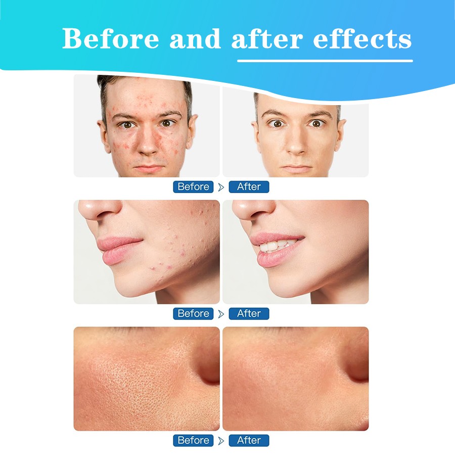 Multifunctional electric ultrasonic facial cleansing brush