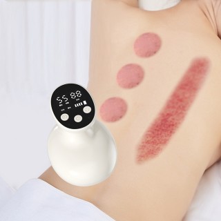 Portable Vacuum Cupping Machine with 10 Acupressure Points - USB-C Rechargeable for Home Use