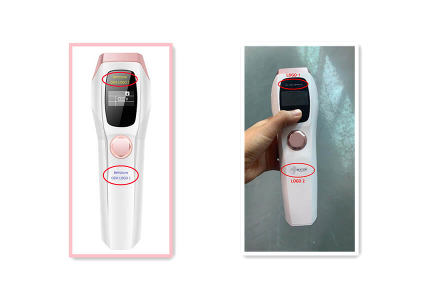 laser hair removal machine at home