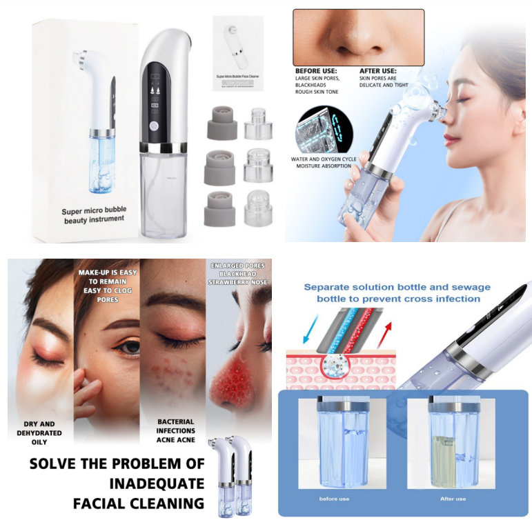 Blackhead Removal