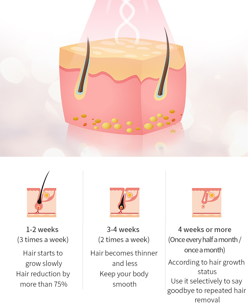 IPL Hair Removal