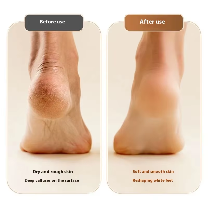 Electric Foot Grinder
