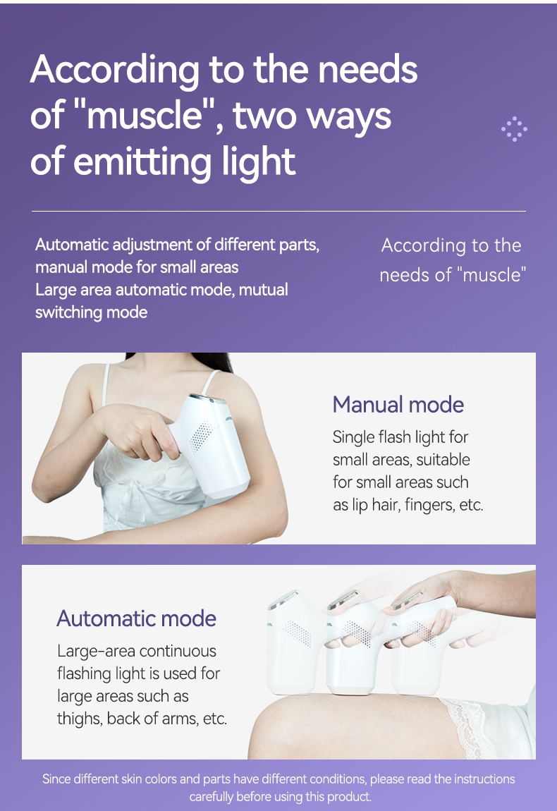 IPL hair removal