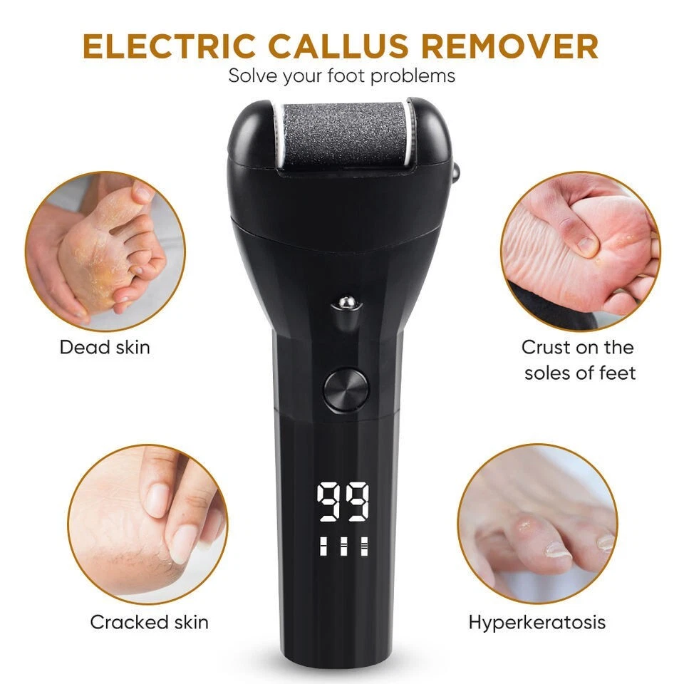 Electric Foot Files