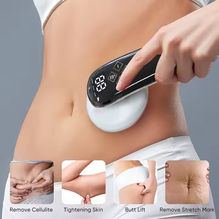 Factory New Design Stretch Mark Removal Burn Cellulite Massager Belly Fat Burner Skin Tightening Device