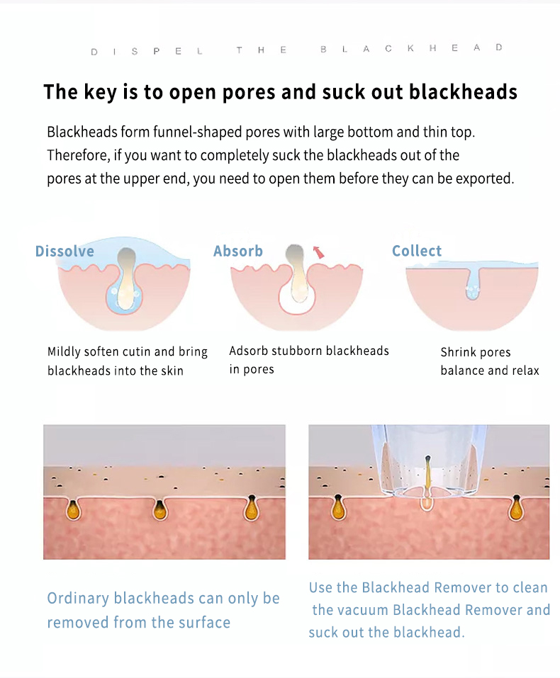 Electric Blackhead Removal