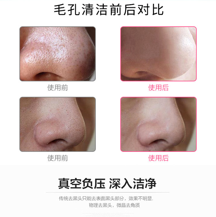 Electric Vacuum Suction Blackhead Remover