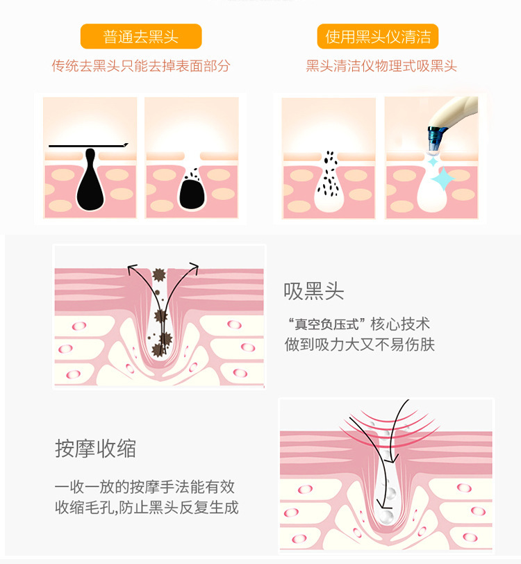 Whitehead Removal