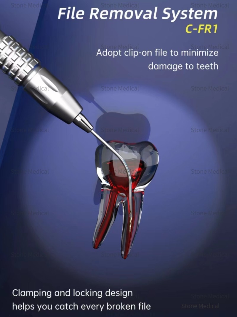 Supply Dental Surgical Endo Broken File Removal System Kits Wholesale