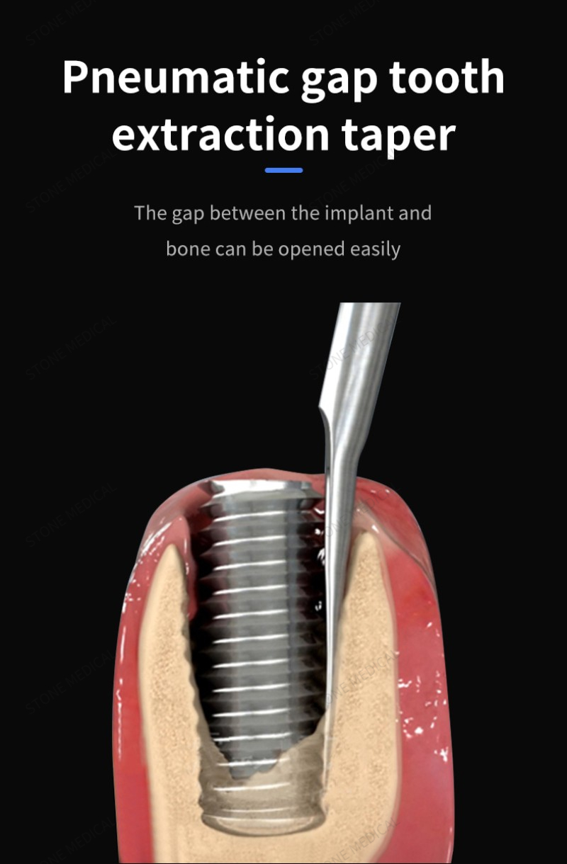 Supply Dental Equipment Pneumatic Dental Elevator Tooth Extraction