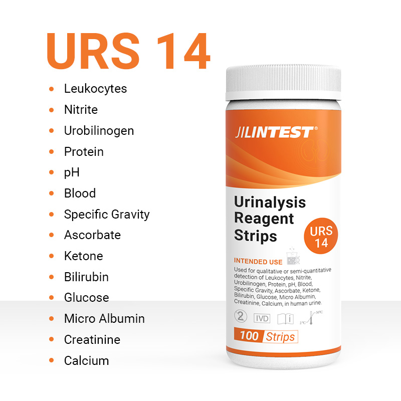 urine test