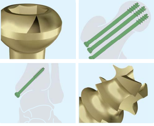 3.5 cortical screw