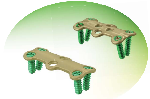 Orthopedic Screws And Orthopedic Plates