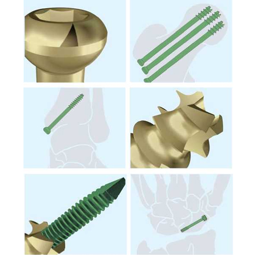 Collarbone Plate And Screws Clavicle Plate And Screws